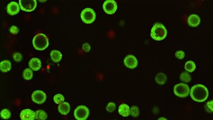 Una biobanca di organoidi per scovare i punti deboli dei tumori 