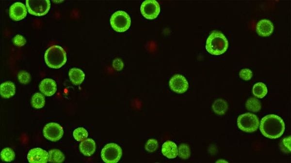 Una biobanca di organoidi per scovare i punti deboli dei tumori 