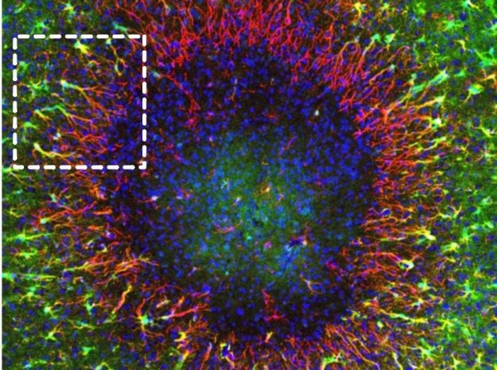 Il cervello può autoripararsi meglio di quanto si pensasse 
