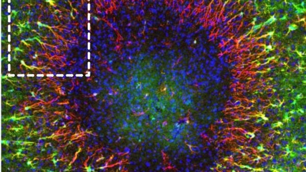Il cervello può autoripararsi meglio di quanto si pensasse 