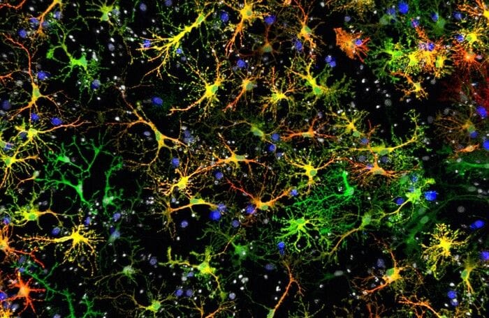 Alzheimer, nanoparticelle rigenerano nei topi i neuroni persi