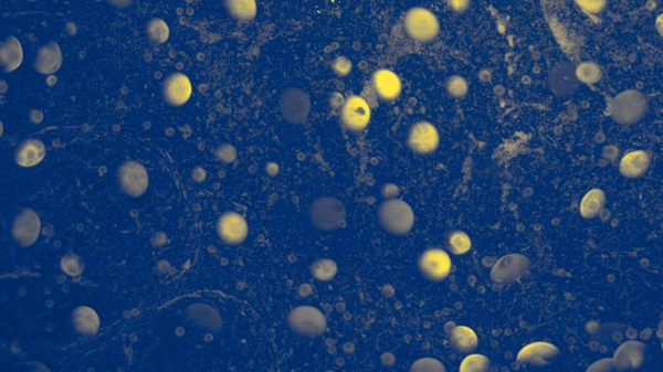L’ovaio conta i suoi ovuli per tutto il ciclo riproduttivo 