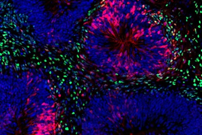 Organoidi di cervello coltivati in laboratorio per 5 anni, è record