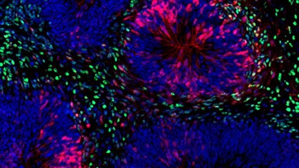 Organoidi di cervello coltivati in laboratorio per 5 anni, è record