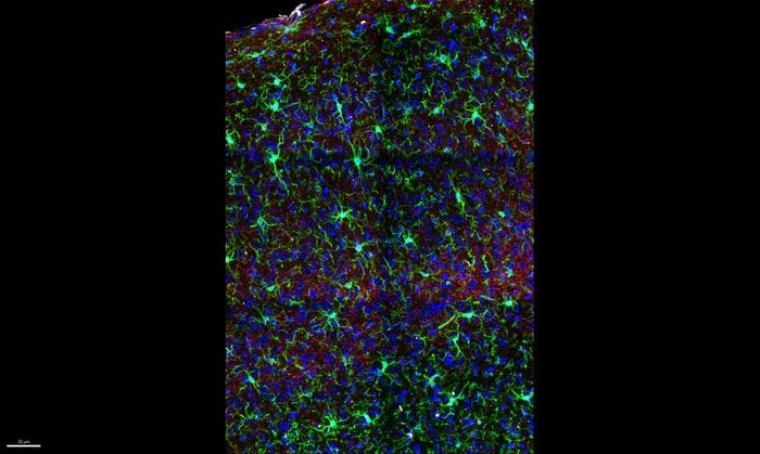 Il cervello femminile è più plastico, i test al risveglio dall'anestesia