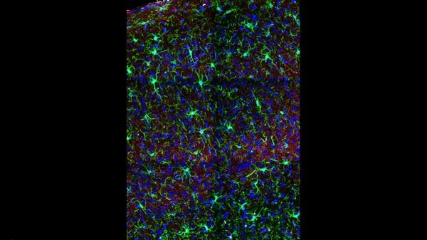 Il cervello femminile è più plastico, i test al risveglio dall'anestesia