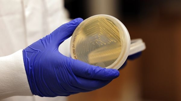 Influenza, funziona nei topi un vaccino universale 