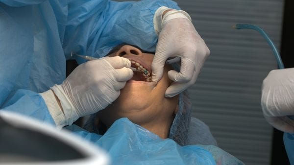 È la carie la malattia non trasmissibile più diffusa al mondo