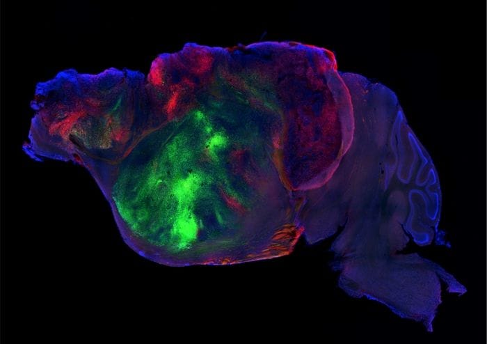 Organoidi di cervello umano in topi, hanno formato circuiti 
