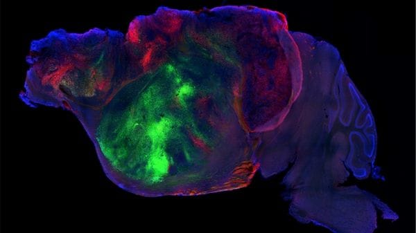 Organoidi di cervello umano in topi, hanno formato circuiti 