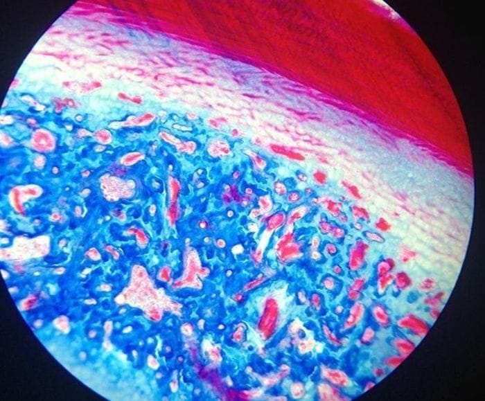 Gli organi invecchiano in tempi diversi, lo indica un'analisi del sangue