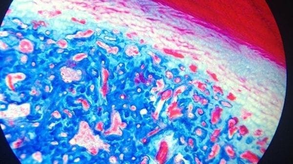 Gli organi invecchiano in tempi diversi, lo indica un'analisi del sangue