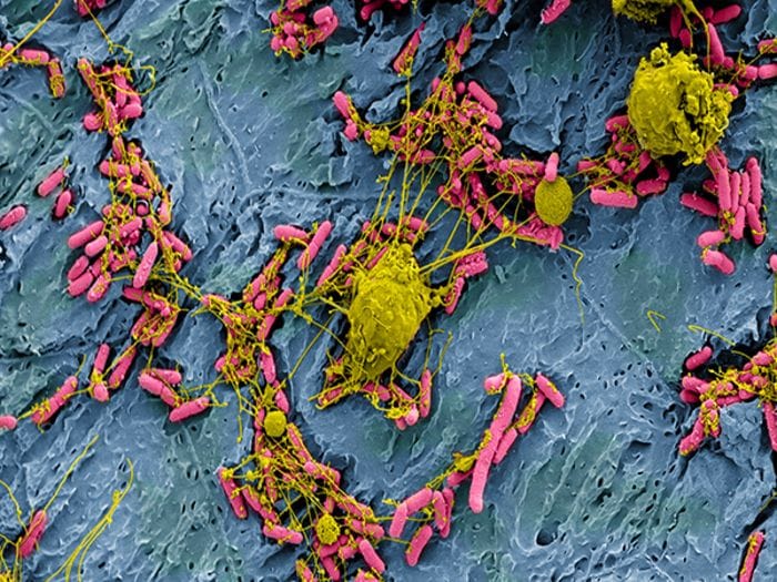 Il sistema immunitario reagisce ai microbi ancor prima di riconoscerli