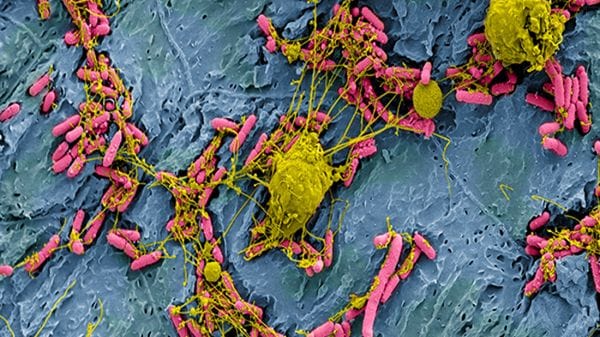 Il sistema immunitario reagisce ai microbi ancor prima di riconoscerli