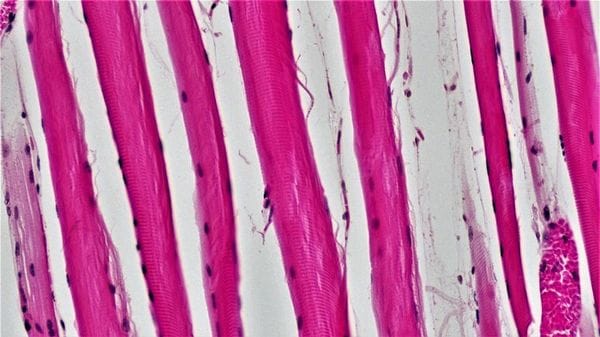 Muscoli ingegnerizzati per collegare le protesi ai nervi rimasti