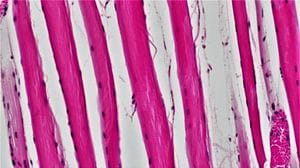 Muscoli ingegnerizzati per collegare le protesi ai nervi rimasti