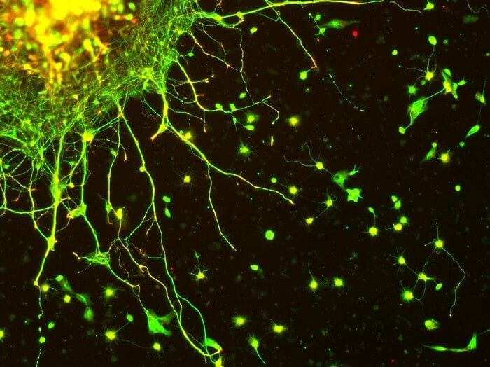 Dalla più grande mappa del cervello indizi sull'invecchiamento