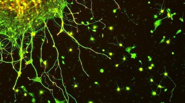 Dalla più grande mappa del cervello indizi sull'invecchiamento