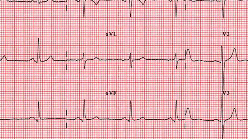 «TC» e «imaging». Vedere (bene) il cuore  per curare meglio