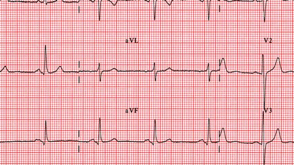 «TC» e «imaging». Vedere (bene) il cuore  per curare meglio