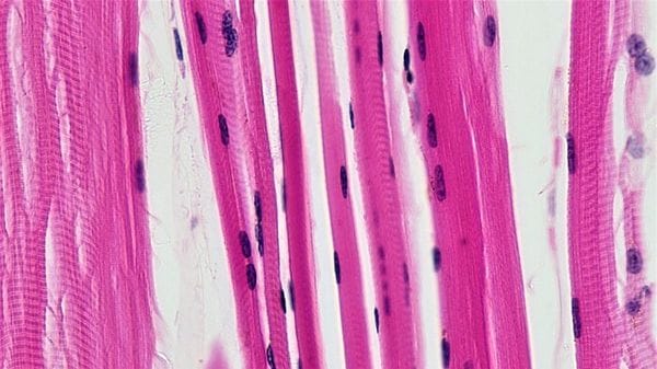 I muscoli invecchiano per autodifesa, individuato l'interruttore 